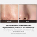 Medicube - Zero Pore Pad 2.0 (70ea)