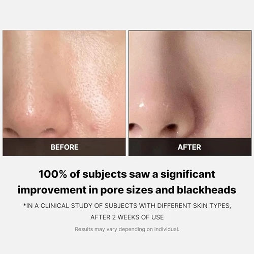 Medicube - Zero Pore Pad 2.0 (70ea)